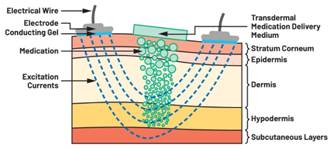 圖5.人體皮膚分層橫截面以及TMD和生物阻抗測量 考慮到生物阻抗分析的無創(chuàng)性,使用兩個金屬電極代表電氣傳感器,連接模擬前端(AFE)電路和患者皮膚。這個金屬與非金屬的接觸點(diǎn)是構(gòu)成整個電路的另一個關(guān)鍵部分,連接了AFE和人體電氣模型。電荷載體(電極中的電子和人體內(nèi)的離子)之間的相互作用可能對這些傳感器的性能產(chǎn)生重大影響,需要根據(jù)每種應(yīng)用進(jìn)行具體考慮。首先,金屬與離子溶液接觸的相互作用導(dǎo)致金屬表面附近溶液中離子濃度的局部變化。這種現(xiàn)象會改變電極下方區(qū)域的電荷中性,導(dǎo)致金屬周圍的電解質(zhì)電位與溶液其余部分不同,從而在金屬和電解質(zhì)主體之間產(chǎn)生一個電位差,即常說的“半電池電位”。其次,注入電流的直流分量會導(dǎo)致電極極化。 表1.各種電極類型和相應(yīng)的半電池電位 金屬及反應(yīng) 半電池電位(V) Al → Al3+ + 3e- Al → Al3+ + 3e- –1.706 –1.706 Ni → Ni2+ + 2e- Ni → Ni2+ + 2e- –0.230 -0.230 H2 → 2H+ + 2e- H2 → 2H+ + 2e- 0.000 (by definition) 0.000(根據(jù)定義) Ag + Cl- → AgCl + e- Ag + Cl- → AgCl + e- +0.223 +0.223 Ag → Ag+ + e- Ag → Ag+ + e- +0.799 +0.799 Au → Au+ + e- Au → Au+ + e- +1.680 +1.680 這是一種不良現(xiàn)象,往往導(dǎo)致電極性能下降。這些考量表明,電極也需要定義適當(dāng)?shù)碾姎饽P停▍⒁妶D6)。我們可以將干電極表示為具有三個串聯(lián)元件的電路:一個用于模擬半電池電位(EHC)的直流電源;一個用于模擬金屬和非金屬(人體)之間接觸的RC并聯(lián)電池(Rd||Cd);以及一個用于模擬電極金屬的電阻Rs。 圖5.人體皮膚分層橫截面以及TMD和生物阻抗測量 考慮到生物阻抗分析的無創(chuàng)性,使用兩個金屬電極代表電氣傳感器,連接模擬前端(AFE)電路和患者皮膚。這個金屬與非金屬的接觸點(diǎn)是構(gòu)成整個電路的另一個關(guān)鍵部分,連接了AFE和人體電氣模型。電荷載體(電極中的電子和人體內(nèi)的離子)之間的相互作用可能對這些傳感器的性能產(chǎn)生重大影響,需要根據(jù)每種應(yīng)用進(jìn)行具體考慮。首先,金屬與離子溶液接觸的相互作用導(dǎo)致金屬表面附近溶液中離子濃度的局部變化。這種現(xiàn)象會改變電極下方區(qū)域的電荷中性,導(dǎo)致金屬周圍的電解質(zhì)電位與溶液其余部分不同,從而在金屬和電解質(zhì)主體之間產(chǎn)生一個電位差,即常說的“半電池電位”。其次,注入電流的直流分量會導(dǎo)致電極極化。 表1.各種電極類型和相應(yīng)的半電池電位 金屬及反應(yīng) 半電池電位(V) Al → Al3+ + 3e- Al → Al3+ + 3e- –1.706 –1.706 Ni → Ni2+ + 2e- Ni → Ni2+ + 2e- –0.230 -0.230 H2 → 2H+ + 2e- H2 → 2H+ + 2e- 0.000 (by definition) 0.000(根據(jù)定義) Ag + Cl- → AgCl + e- Ag + Cl- → AgCl + e- +0.223 +0.223 Ag → Ag+ + e- Ag → Ag+ + e- +0.799 +0.799 Au → Au+ + e- Au → Au+ + e- +1.680 +1.680 這是一種不良現(xiàn)象,往往導(dǎo)致電極性能下降。這些考量表明,電極也需要定義適當(dāng)?shù)碾姎饽P停▍⒁妶D6)。我們可以將干電極表示為具有三個串聯(lián)元件的電路:一個用于模擬半電池電位(EHC)的直流電源;一個用于模擬金屬和非金屬(人體)之間接觸的RC并聯(lián)電池(Rd||Cd);以及一個用于模擬電極金屬的電阻Rs。